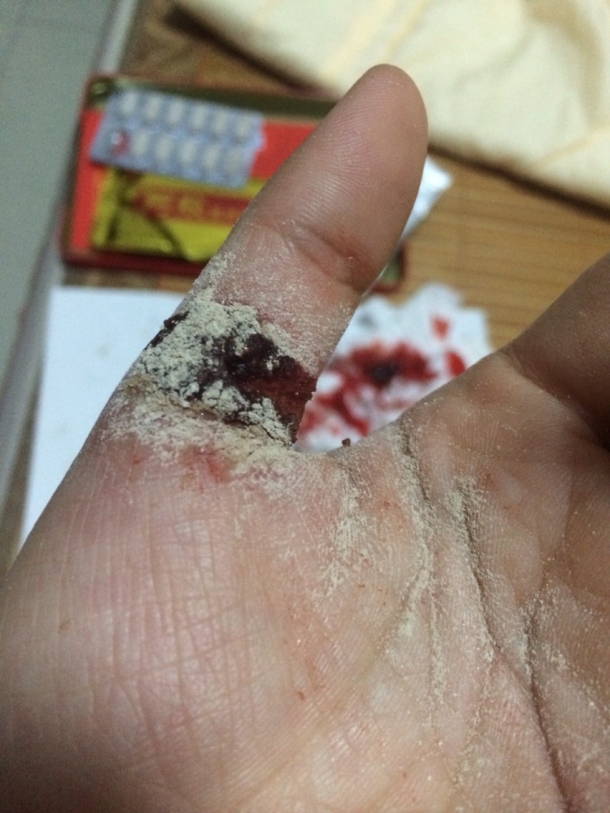 手割破,血流不止,哭
