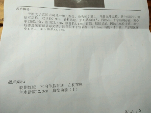 产检报告:左枕前位是什么意思