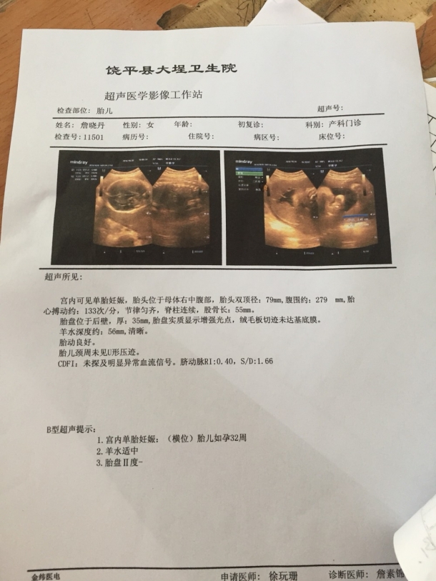 32周胎位横位,趴了一个星期愣是没转过来
