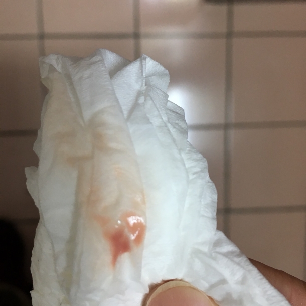 怎么有粉色排泄物