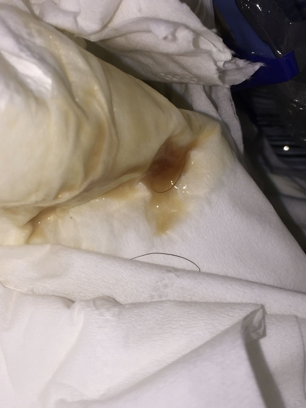 现在是这个,不知道是不是传说中的宫颈黏液栓流出来了
