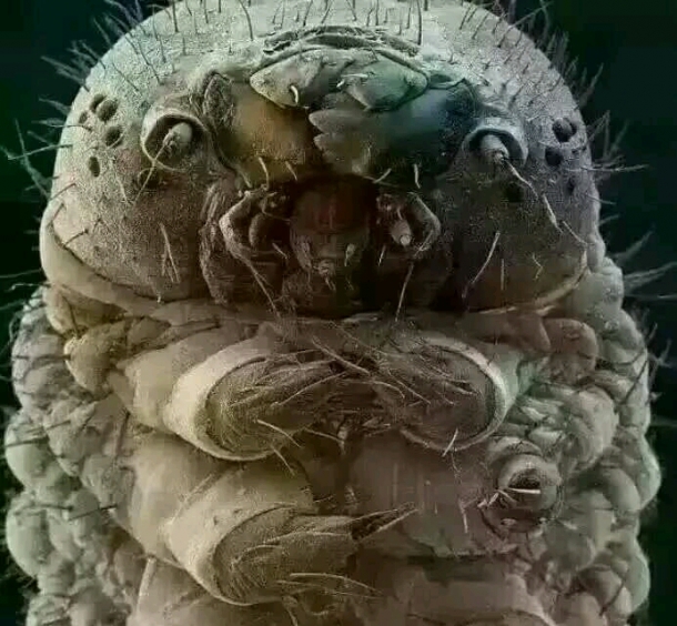 滴虫性阴道炎可怕吗
