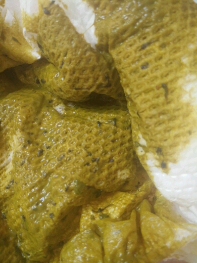宝宝拉屎有黑色线怎么回事,觉得恶心别进来
