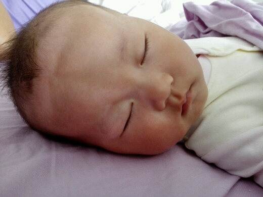 宝宝脸部肤色不均匀怎么回事,看图? - 幼儿护理