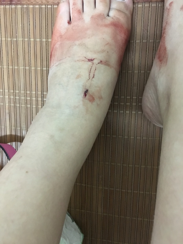 16楼 主题:一场血腥家暴