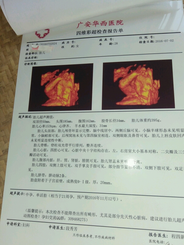 这是我今天去打的四维彩超各位宝妈帮我看一下是男孩还是女孩