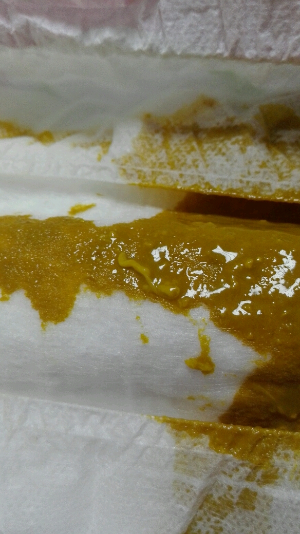 宝宝拉粑粑…觉得恶心的勿进!