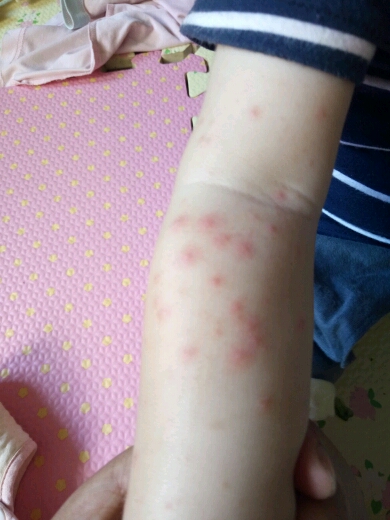 急急急,有没宝妈懂的.
