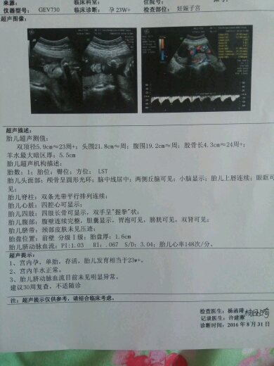 这个b超单怎么看是男胎