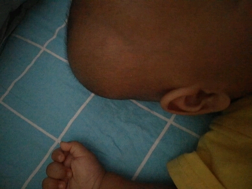 四个月宝宝摔了头上长个大包,几天还没消该怎