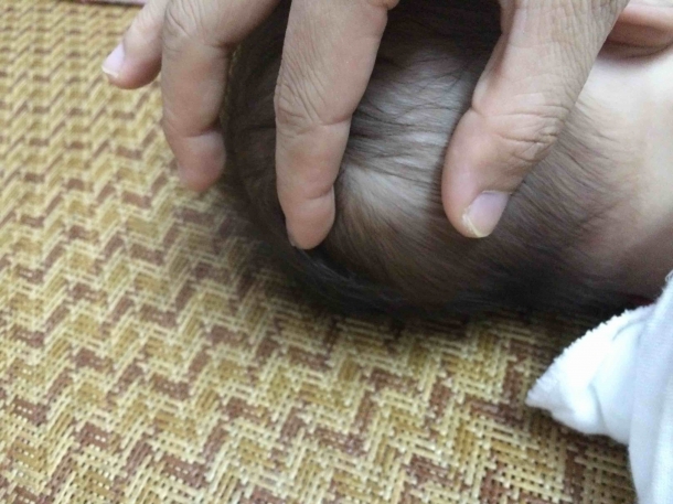 宝宝头上摸起来有个硬包 - 幼儿护理论坛 - 育儿论坛