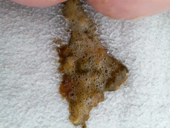 3个月宝宝拉稀 - 幸福母乳站论坛