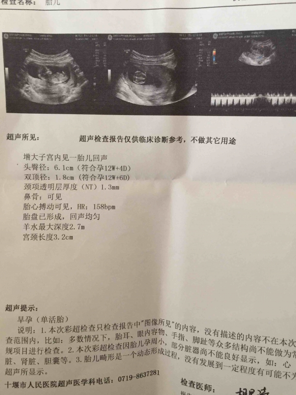 nt归来,一切正常!