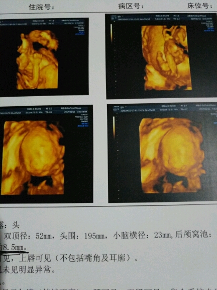 四维彩超顺利归来[可爱][可爱],宝宝加油!