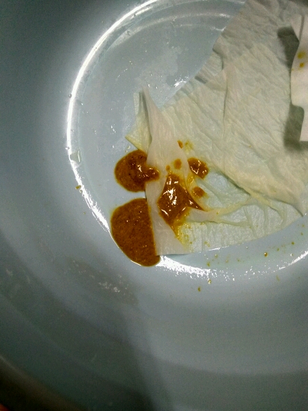 药今天拉这样，颜色正常的金黄色，只是灯光问题照起来不黄，这样正常吗