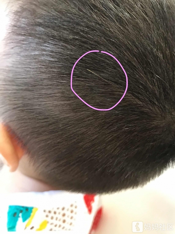 突然发现儿子有个白头发