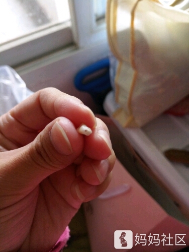 孩子爸把孩子的牙齿拔断了怎么办 - 幼儿护理