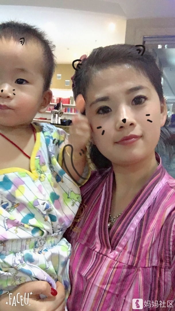 宝妈们 我额头涨了好多闭口粉刺怎么办?怎么去