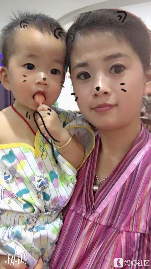 宝妈们 我额头涨了好多闭口粉刺怎么办?怎么去