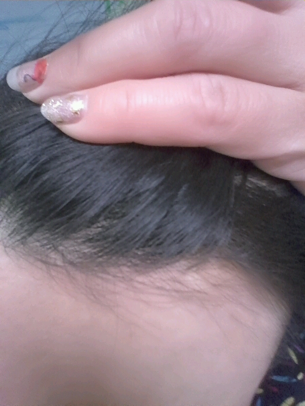 终于不掉发了 - 流行时尚论坛