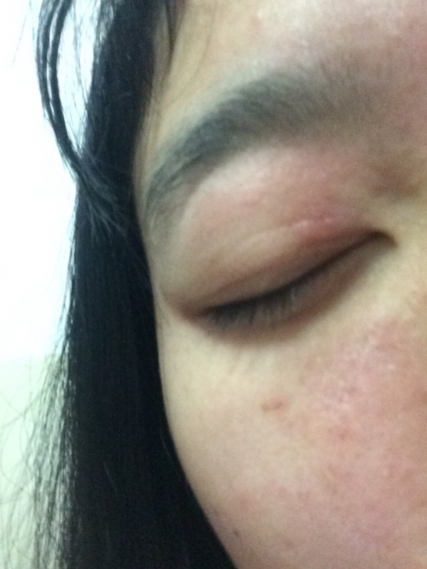 使用护肤品过敏能退吗? - 流行时尚论坛