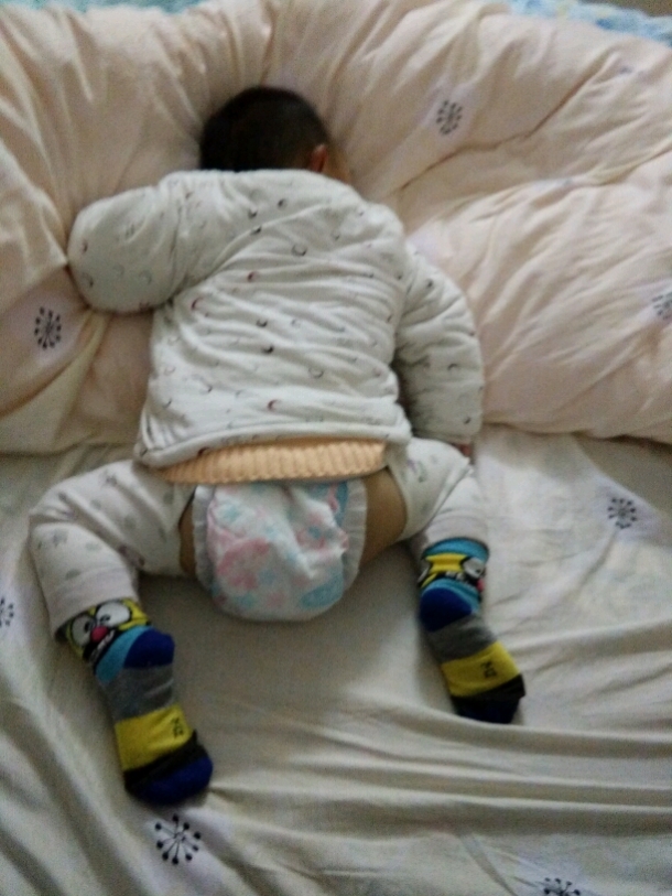 宝宝老受伤留疤破相了 - 幼儿护理论坛