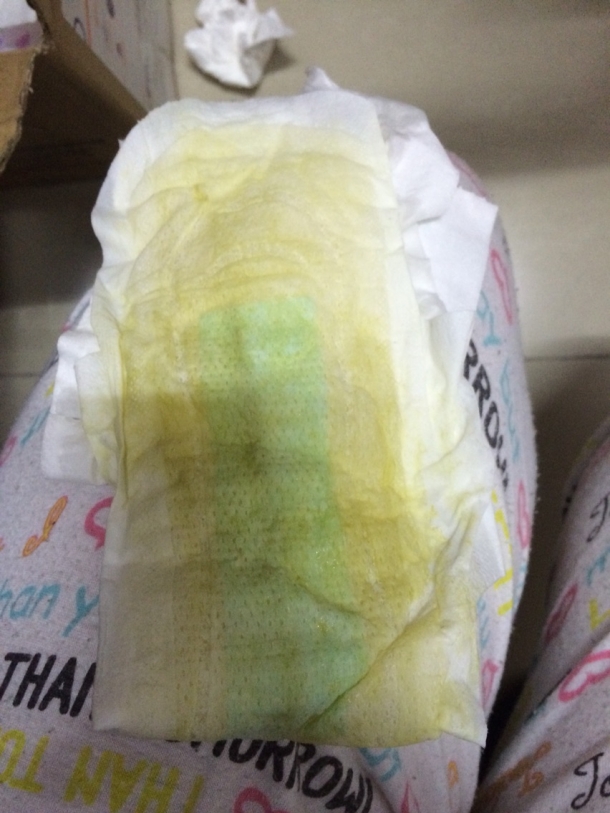 整个卫生巾都湿透了.裤子也湿了.为什么是黄色的?这到底是不是羊水?