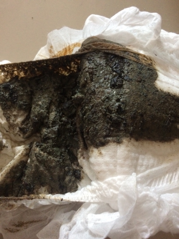 宝宝拉屎绿色怎么回事,(图片恶心介意慎入), - 幼