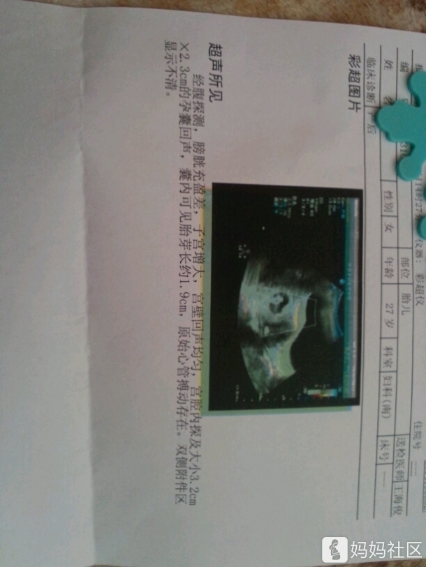 55天了 看孕囊是女孩