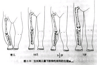 一周多点宝宝 o型腿!