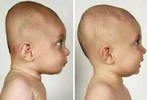 对于宝宝的头型睡扁的到底好不好? - 幼儿护理