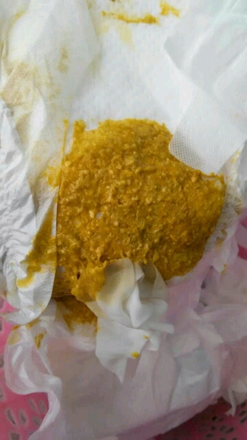 我家宝宝最近大便有奶瓣怎么回事
