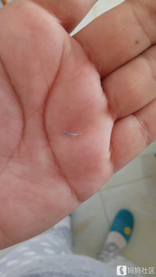 侧切,肉线