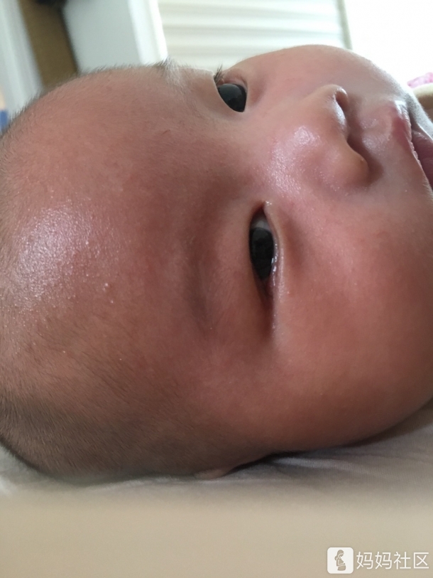 宝宝右边眼角老是流泪是怎么回事啊?