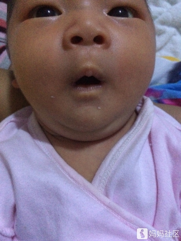 宝宝脖子肉多,起痱子了怎么办? - 幼儿护理