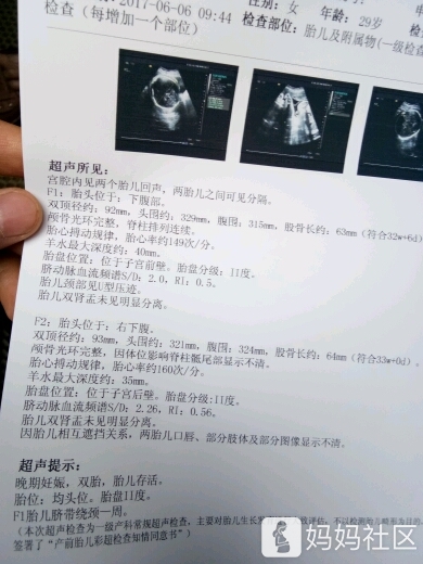 报喜还原了,喜得龙凤胎