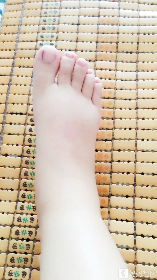 耻骨痛,脚肿,那里都难受……天气热的也受不了,快出来吧!