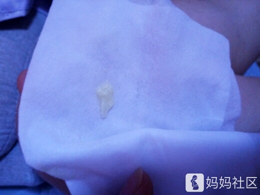 急急急,刚洗澡看到白带黄色像鼻涕