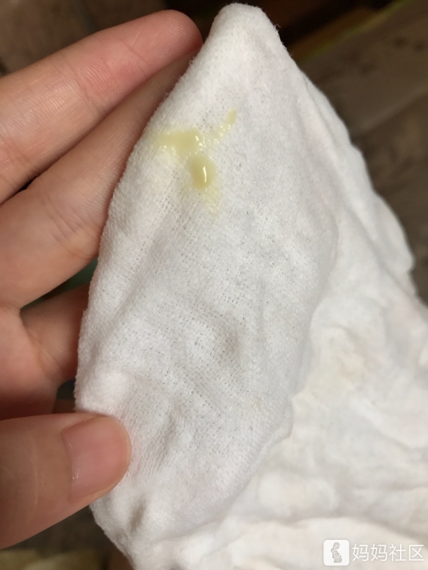 宝宝两个多月,下面有黄色分泌物是怎么回事?