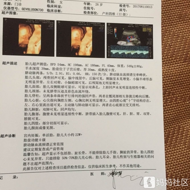 女宝四维彩超,宝妈们可以对比一下