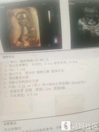 13周的b超图