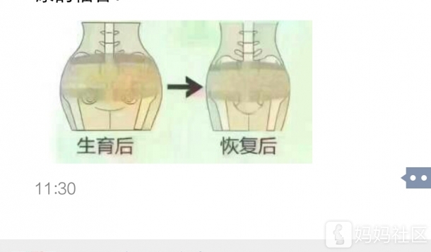 盆腔闭合术