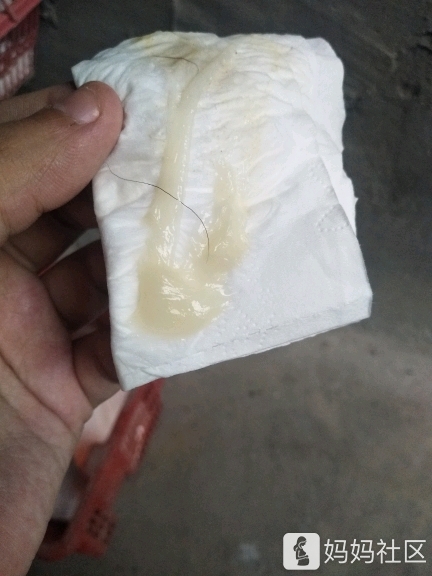 果冻状分泌物,是快生了吗?有图慎入