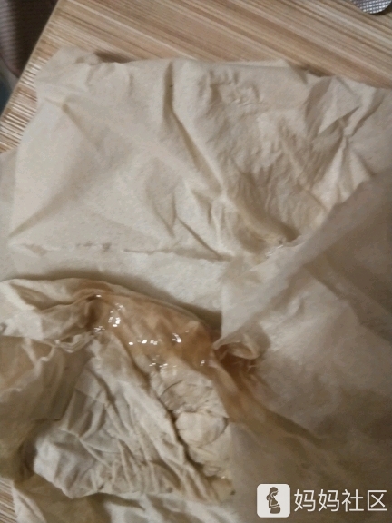 为啥我一到排卵期的时候就会有褐色的分泌物流出来,这是不是得什么病