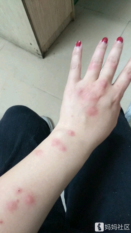 海南三亚虫子太多了