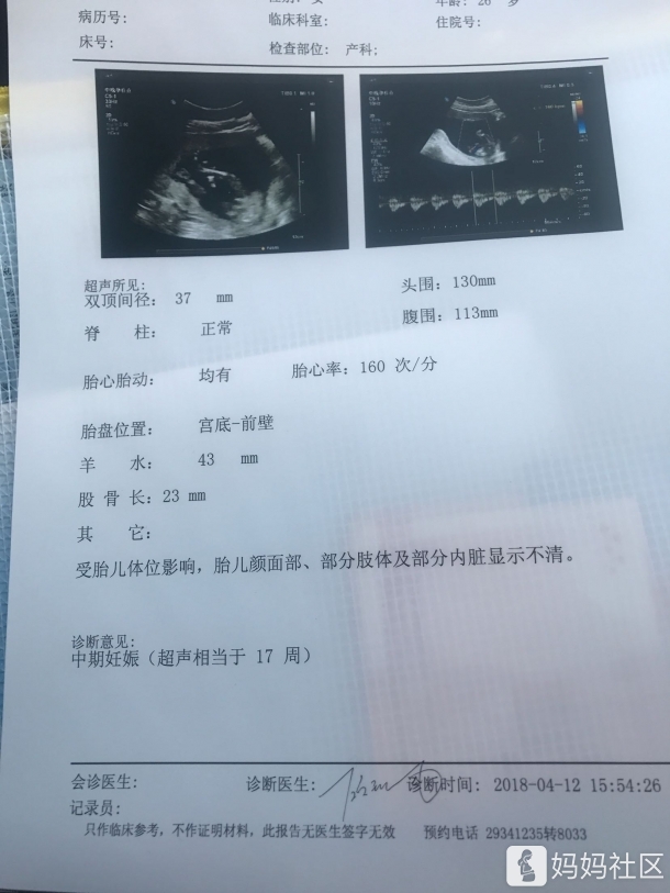 胎心率有点高