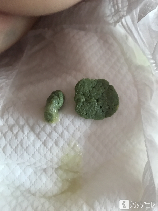 病毒性腹泻一天拉十次左右,今天第六天了还不好,急急急