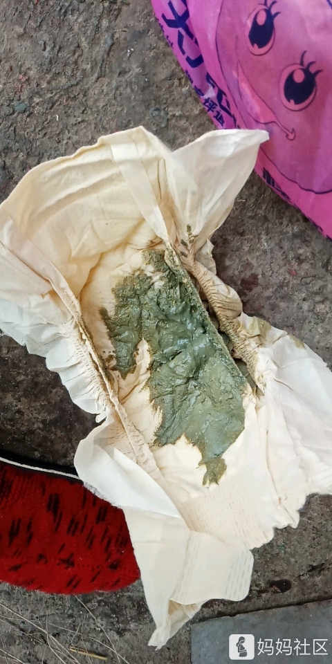 宝宝三个月了拉了半个月绿色便便正常么