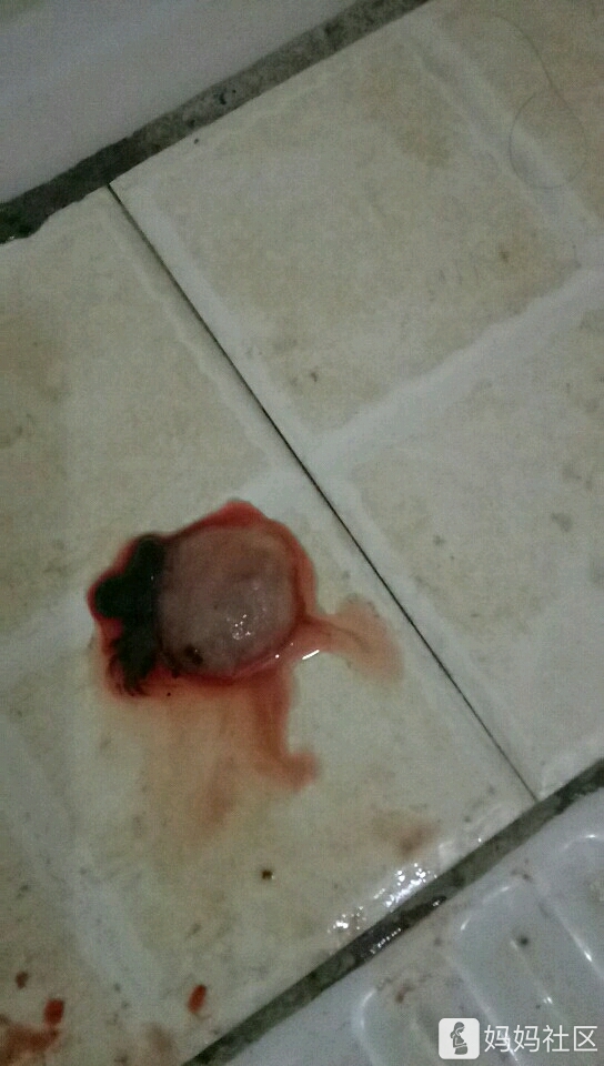 40天,就算这个是个女孩吧,生出来带两个小娃娃我也受不了,我怀孕生子
