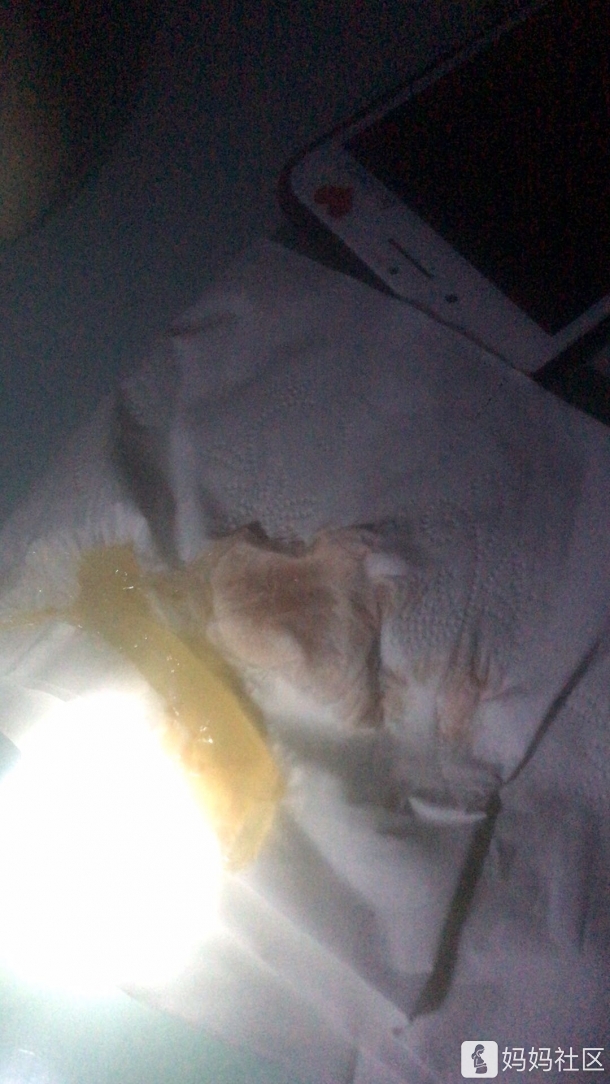刚才下体流了一点水,现在上厕所又有这么多分泌物带点粉色,有轻微的